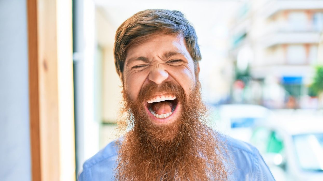 A man with a long, scraggily red beard laughs with his mouth wide open