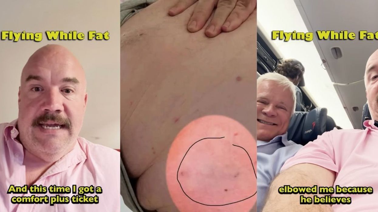 Comedian Guy Branum says a fellow Delta passenger elbowed him mid-flight in a fat-shaming dispute over space.