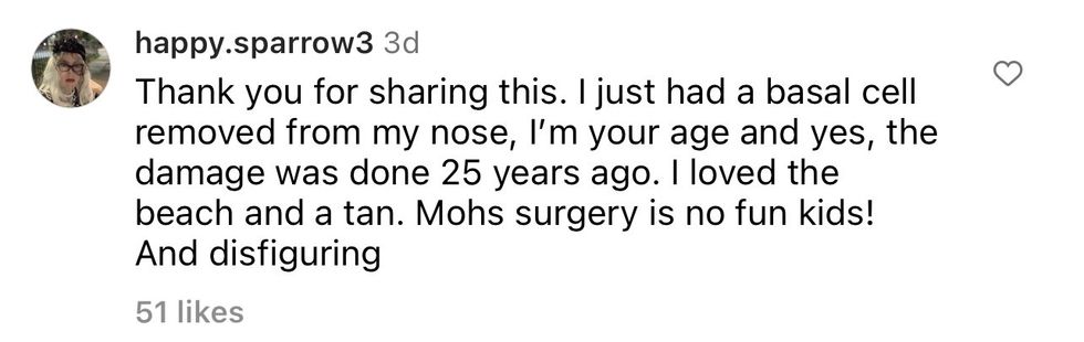Comment from Instagram user happy.sparrow3 "Thank you for sharing this. I just had a basal cell removed from my nose, I'm your age and yes, the damage was done 25 years ago. I loved the beach and a tan. Mohs surgery is no fun ids! And disfiguring"
