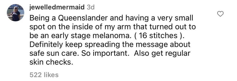 Comment from Instagram user jewelledmermaid "Being a Queenslander and having a very small spot on the inside of my arm that turned out to be an early stage melanoma. (16 stitches). Definitely keep spreading the message about safe sun care. So important. Also get regular skin checks."