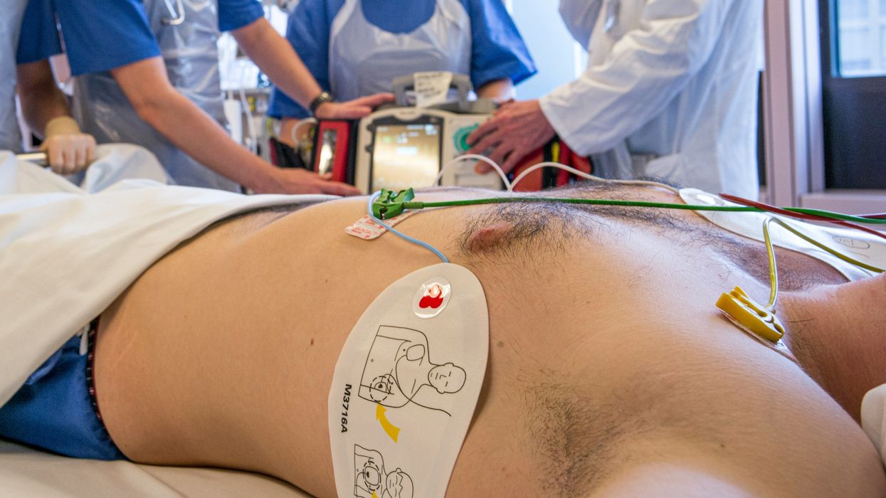 Doctors and nurses perfomring defibrillation on a patient
