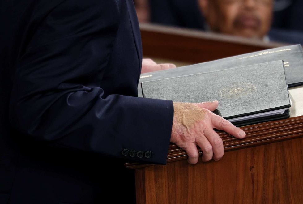 Donald Trump's discolored hand during his State of the Union address