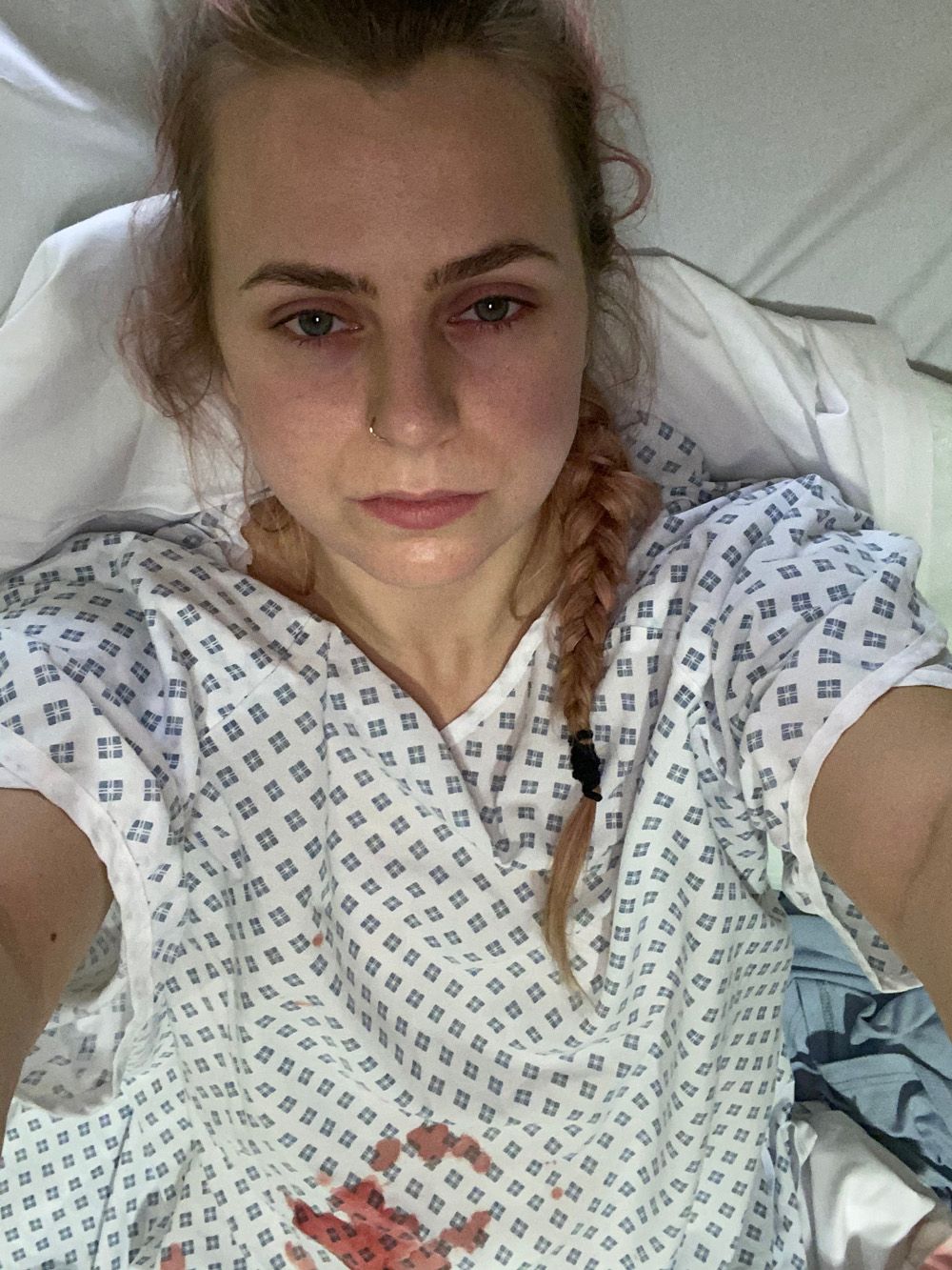 Woman in hospital bed