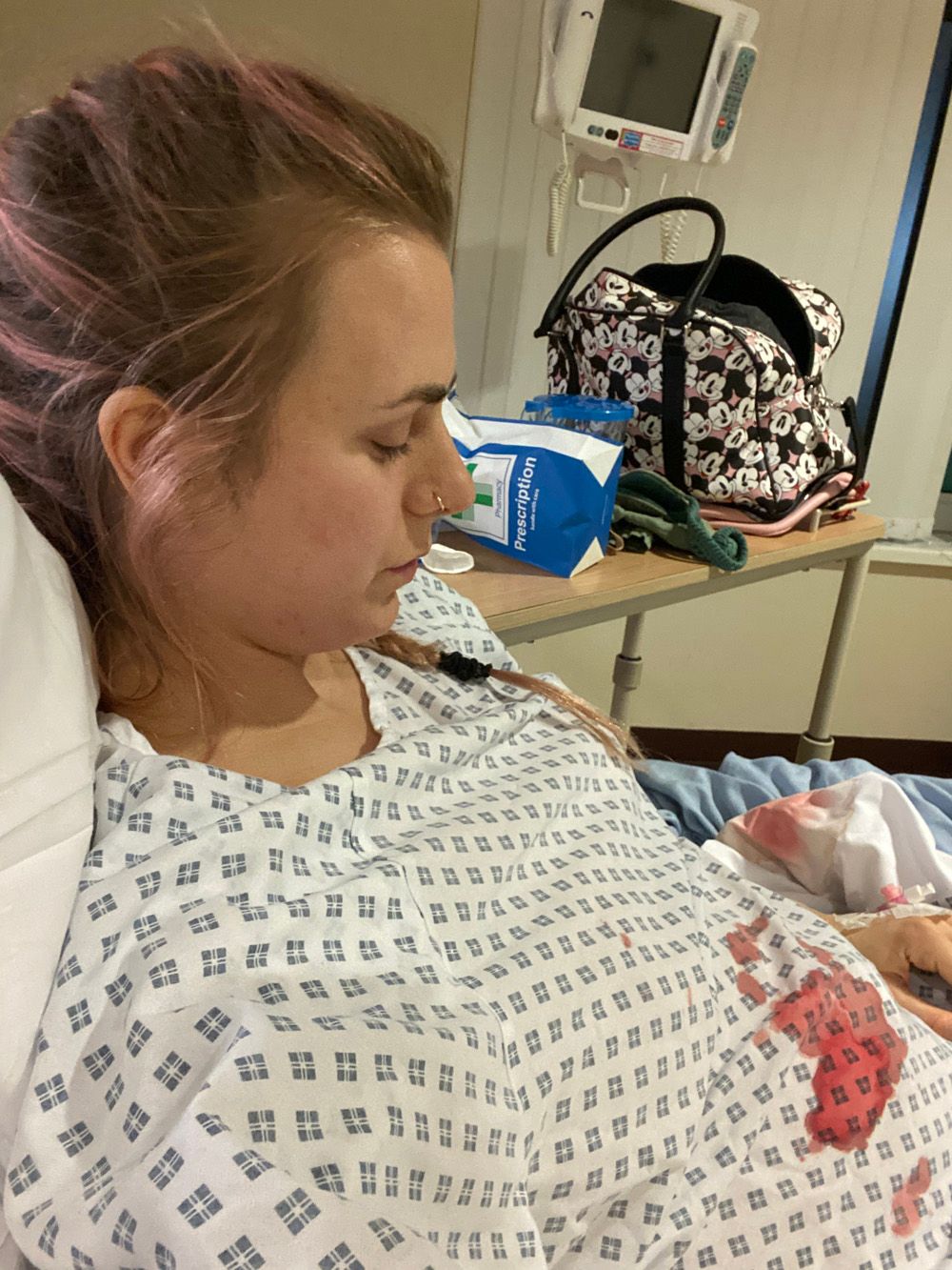 Woman in bloodstained hospital gown