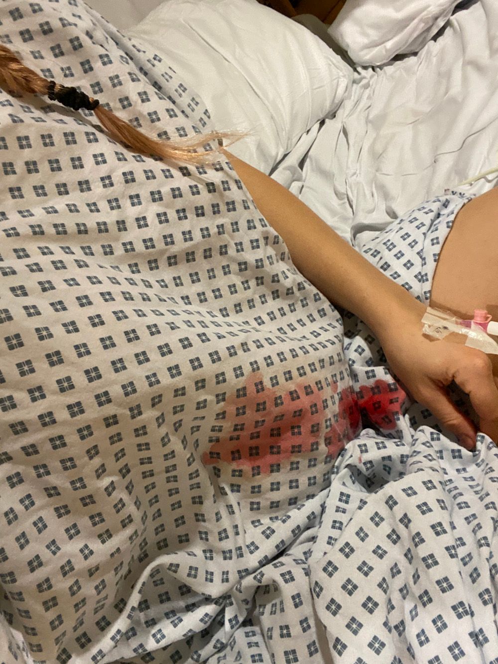 Bloodstained hospital gown