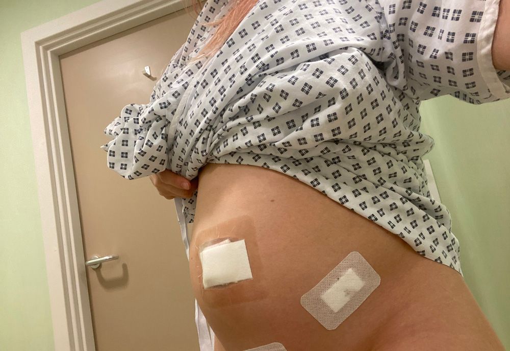 Woman's swollen stomach with bandages