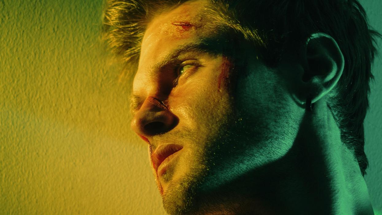 People Describe The Dumbest Ways They've Ever Gotten A Scar