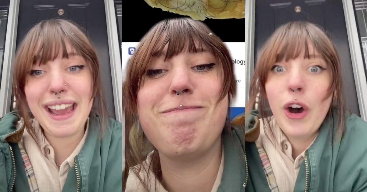 Woman Horrified After Ultrasound Shows She's Had Teeth And Hair Growing In Her Uterus For Two Years