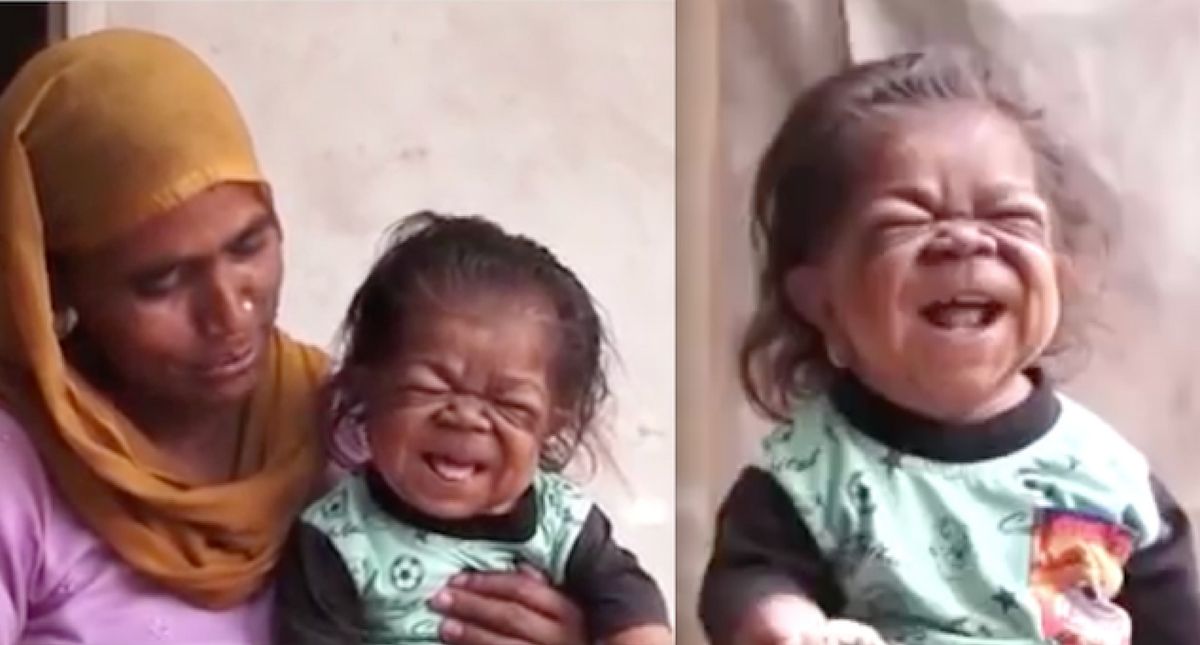 This 23-Year-Old Is Trapped In The Body Of A 1-Year-Old