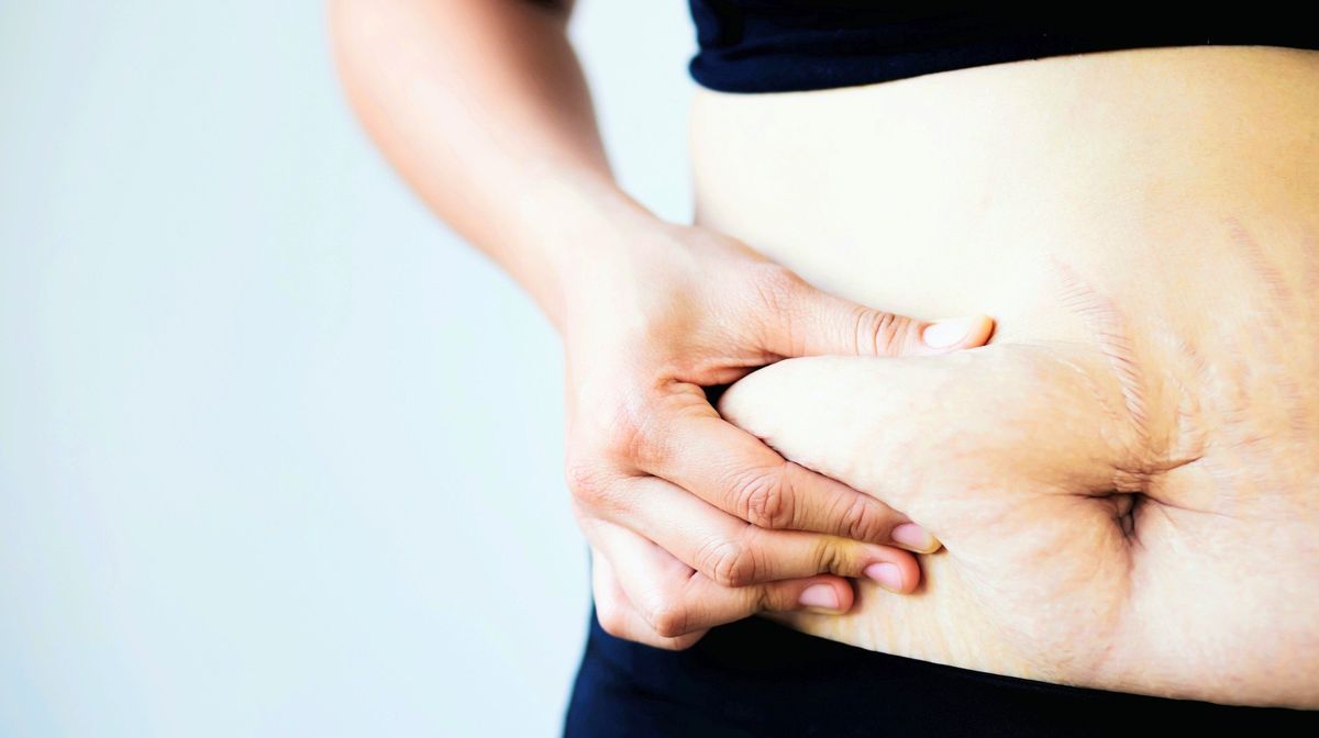 Dad Refuses To Pay For His Ex-Wife's Plastic Surgery After She Blames Him For Pregnancy Ruining Her Body