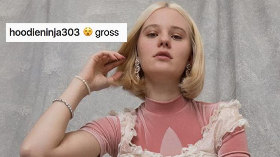 Adidas Model Gets Rape Threats After Posing with Unshaven Legs