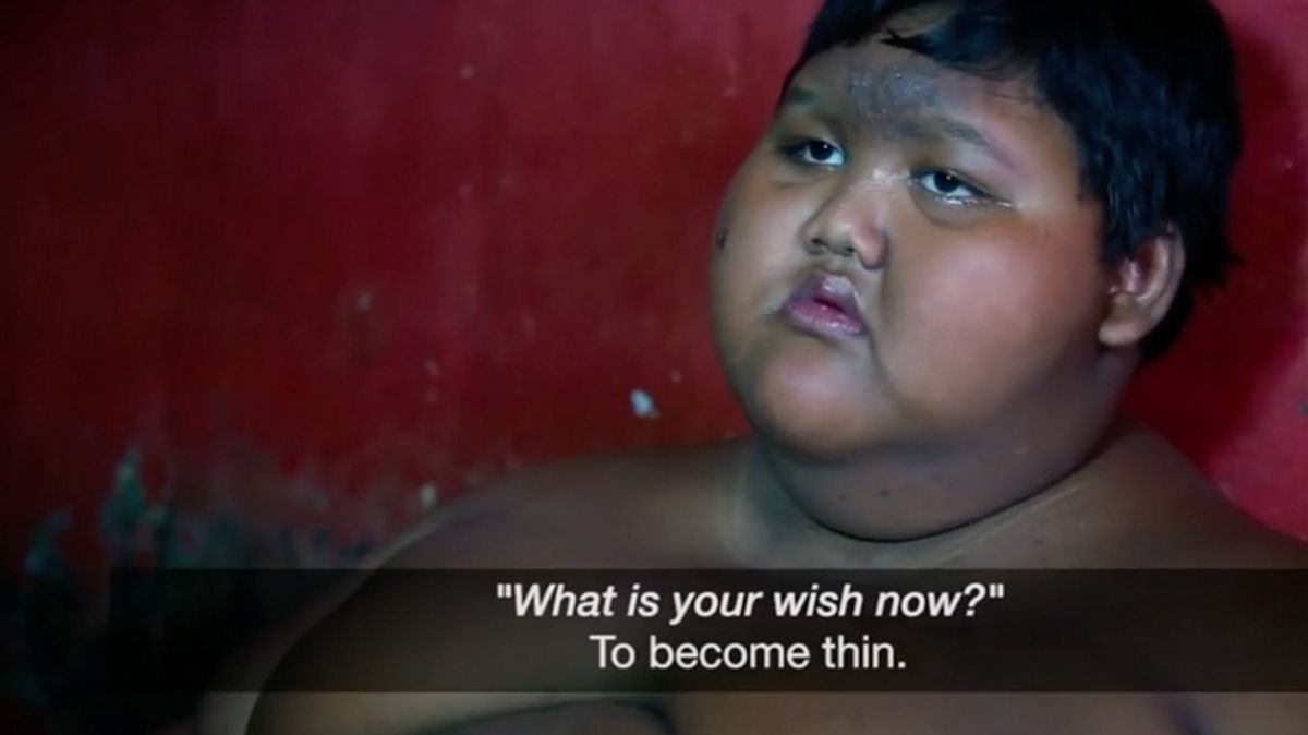 12-Year-Old Arya Permana Loses Enough Weight Enabling Him to Walk to School