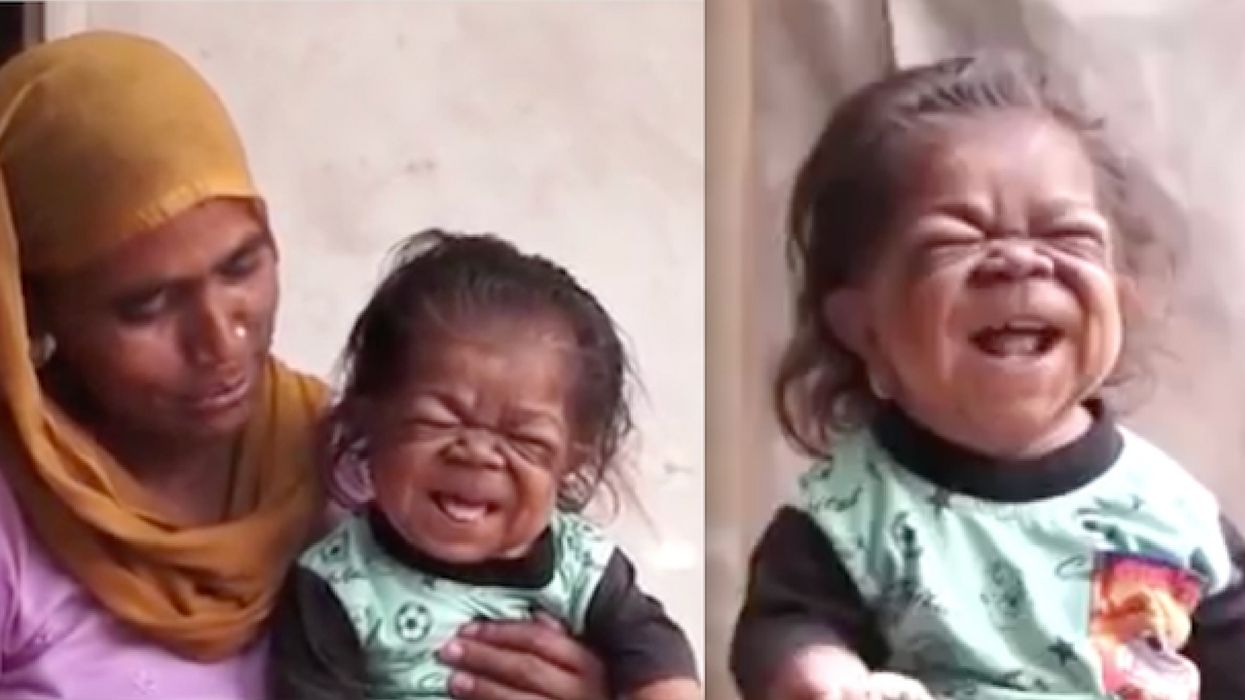 This 23-Year-Old Is Trapped In The Body Of A 1-Year-Old