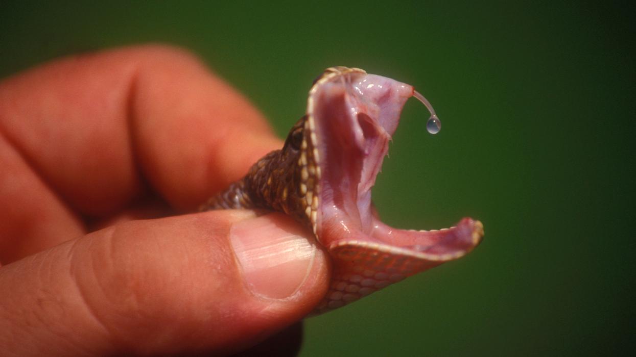 Man Falls Into Coma And Almost Dies After Severed Snake Head Bites Him On The Hand 😱