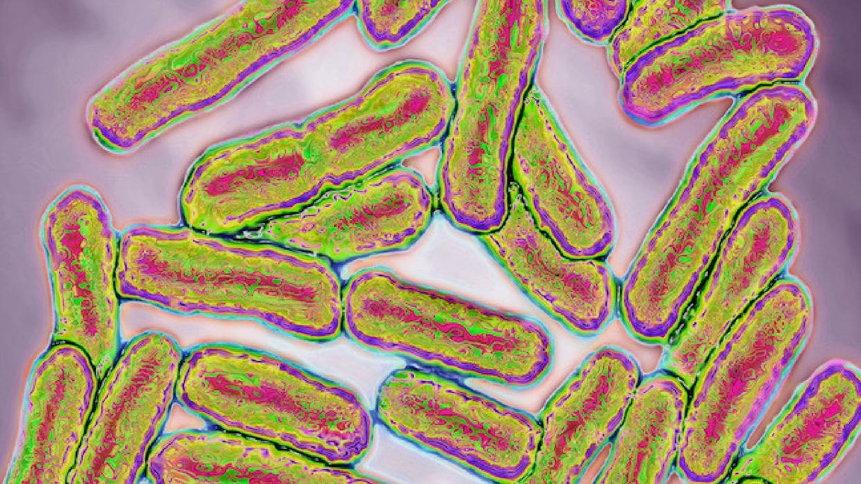 If You've Been Buying Pre-Cut Melon, You May Be At Risk