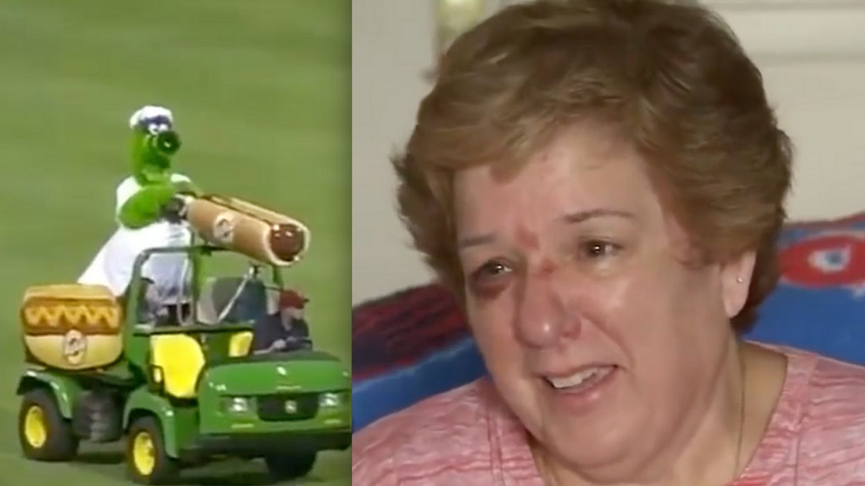 Hot Dog Launcher Accidentally Fires Into Fan's Face At Baseball Game, Giving Her A Black Eye 🌭😵