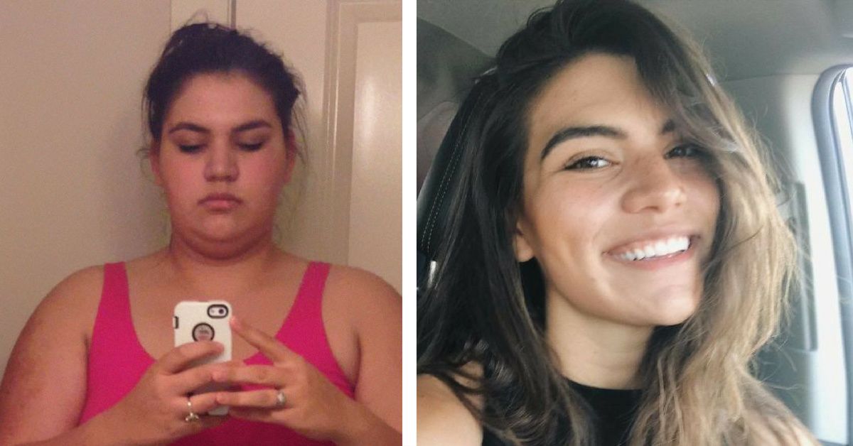 Woman Who Weighed Over 300 Pounds Shares Before And After Transformation Photos From Losing Weight Over 3 Years