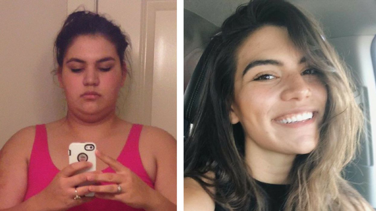 Woman Who Weighed Over 300 Pounds Shares Before And After Transformation Photos From Losing Weight Over 3 Years