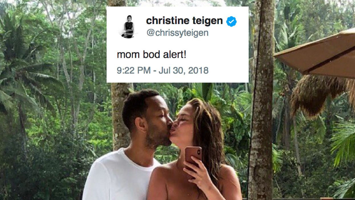 Chrissy Teigen Gets Candid About Her Stretch Marks And Being 'Super Insecure' With Her Body