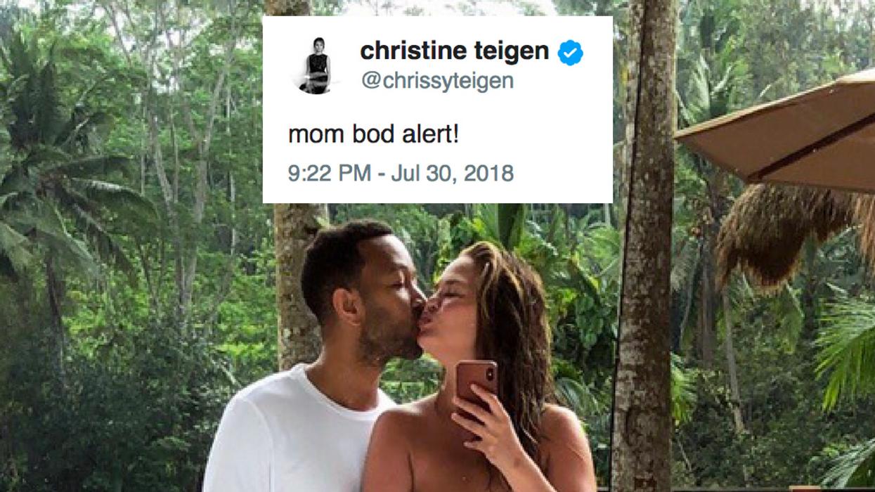 Chrissy Teigen Gets Candid About Her Stretch Marks And Being 'Super Insecure' With Her Body