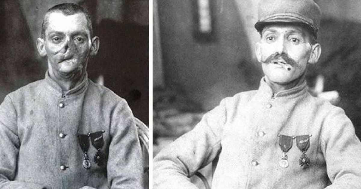 Old Photos Reveal How A Compassionate Sculptor Helped 'Restore' The Faces Of Disfigured WWI Veterans