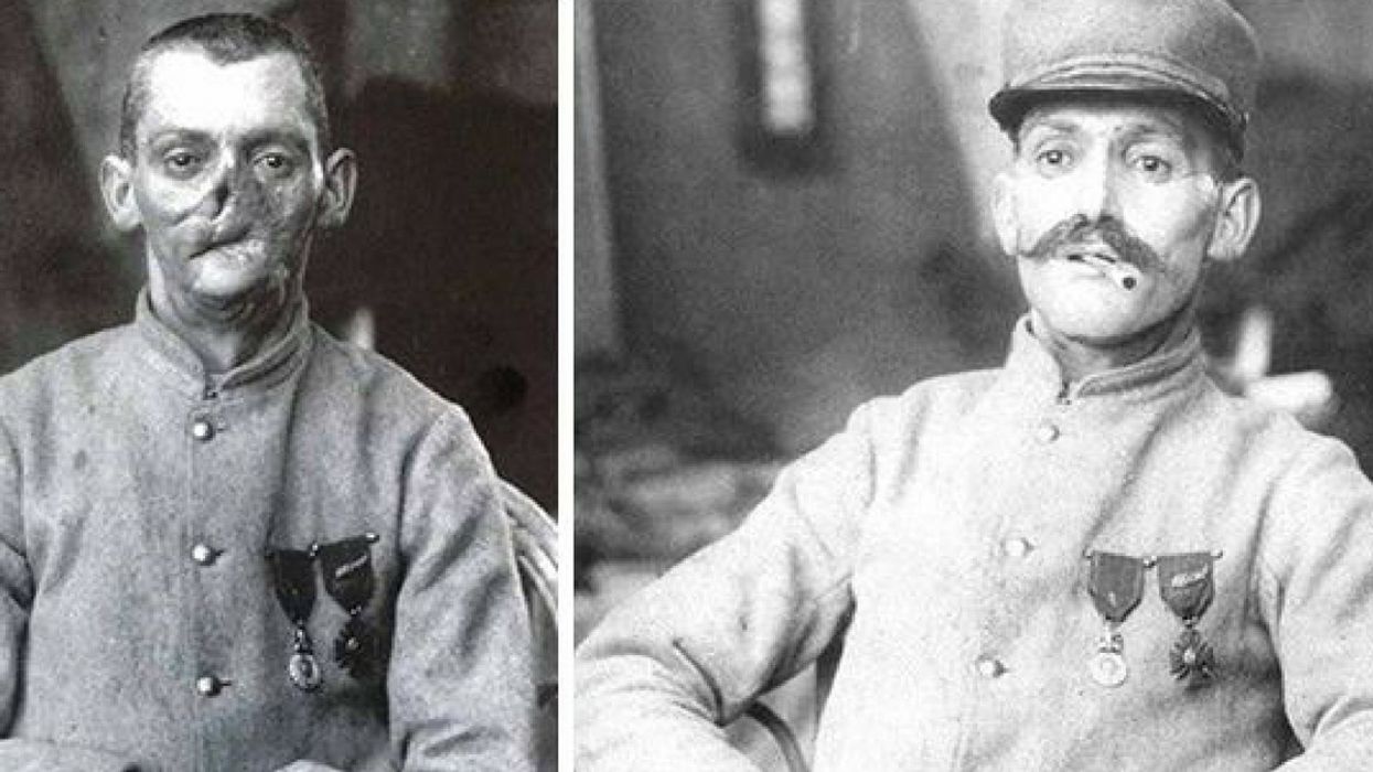 Old Photos Reveal How A Compassionate Sculptor Helped 'Restore' The Faces Of Disfigured WWI Veterans
