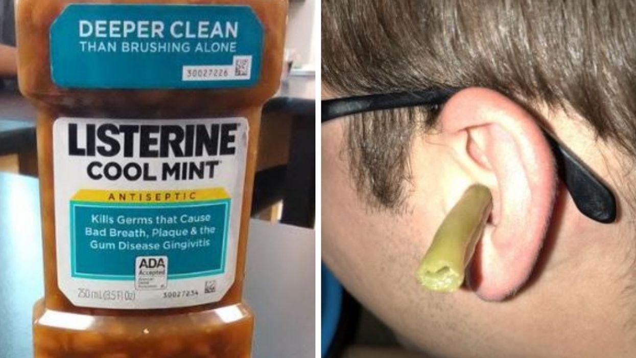 There's A Facebook Group Dedicated Entirely To Beans In Unusual Places—And We Can't Get Enough 😂