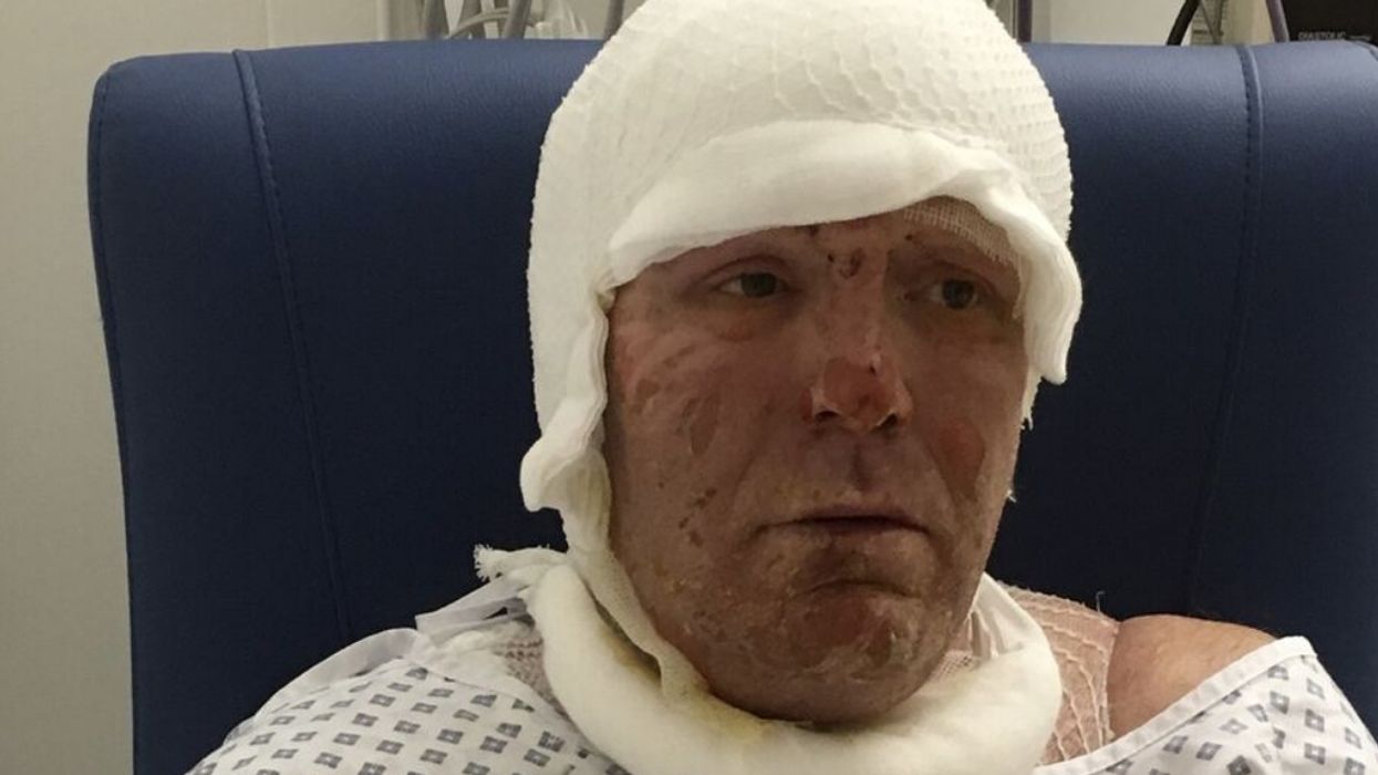 Quick-Thinking 10-Year-Old Saved His Dad's Life When He Turned Into A Human Fireball