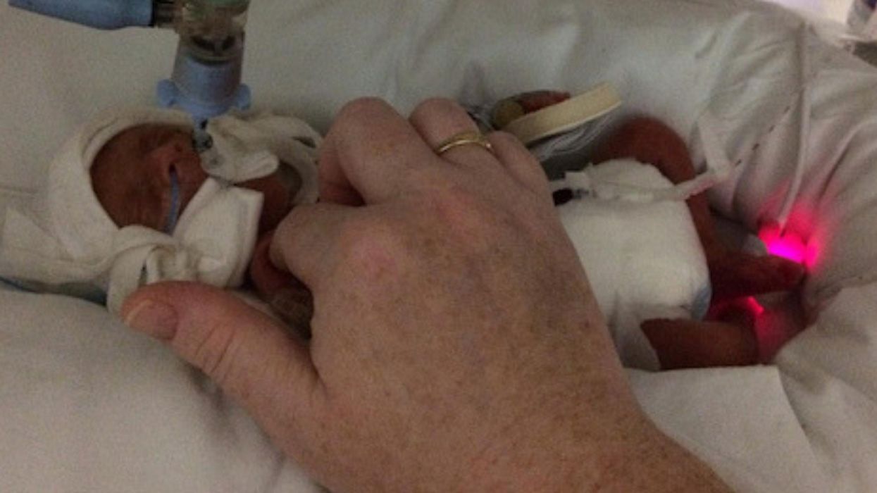 "Miracle" Baby Survives Being Born Almost Four Months Early At Just 1lb 4oz