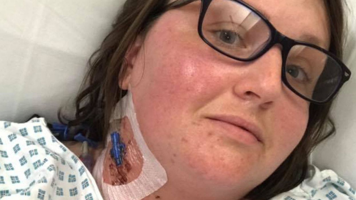 Woman Has Leg Amputated After An Insect Bite Sparks Years Of Agonising Pain