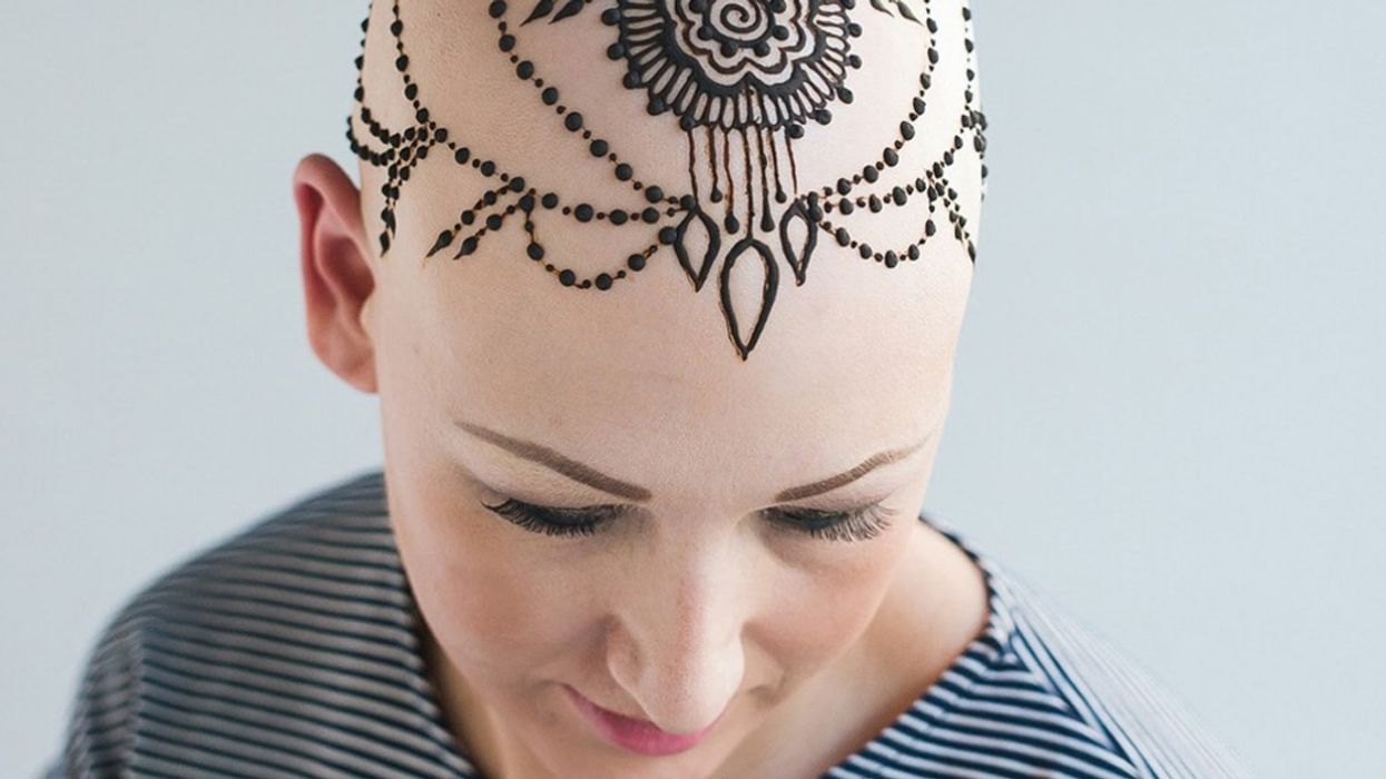 Woman Who Previously Slept In Hats To Hide Her Alopecia Is Now Baring All And Embracing It