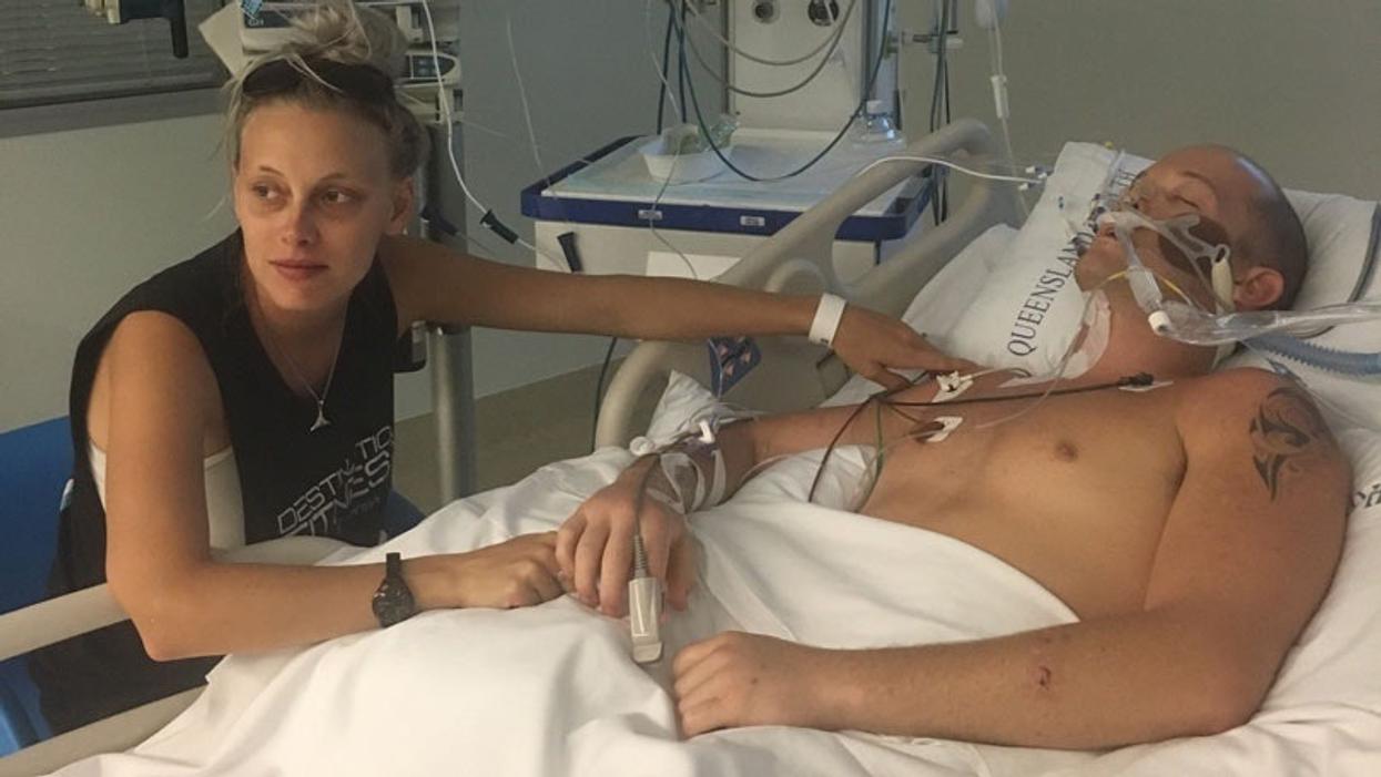 Man Shares Photos From Shark Attack That Cost Him His Leg