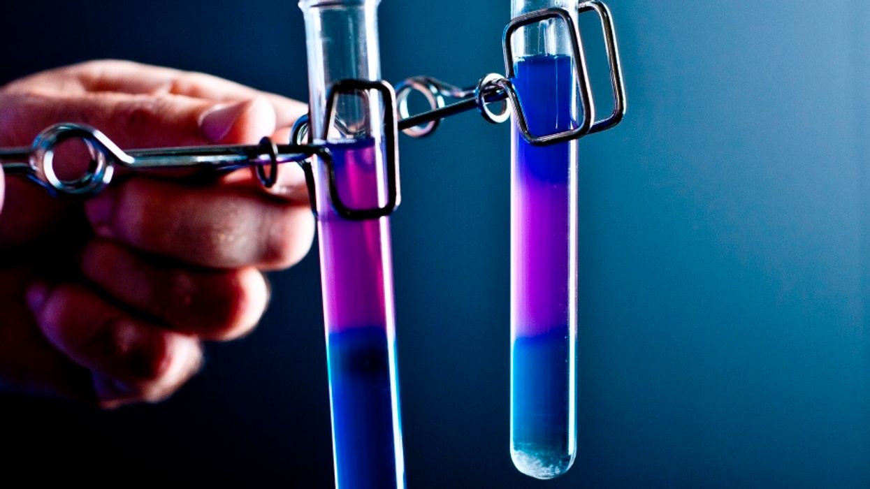 People Who Took A DNA Test Explain What Their Results Said About Them