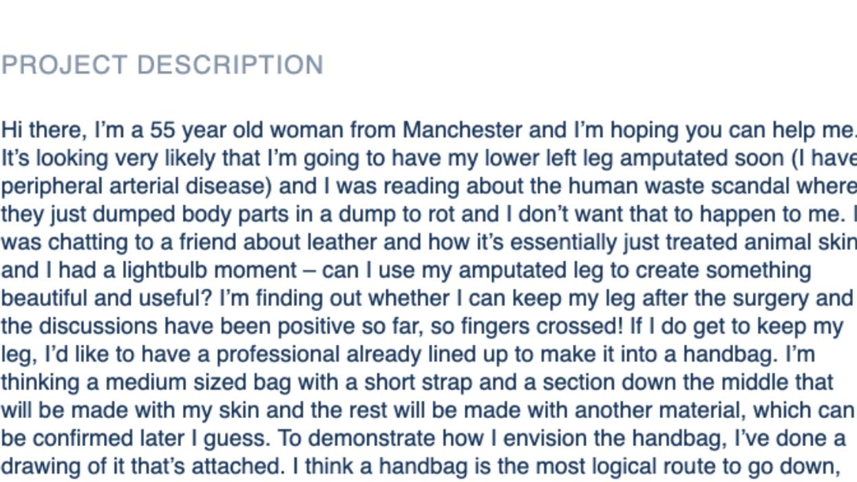 Amputee Posts Request For Handbag Design Using Flesh From Her Lost Leg