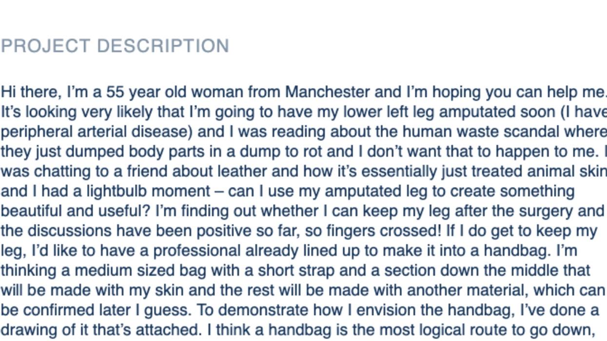 Amputee Posts Request For Handbag Design Using Flesh From Her Lost Leg