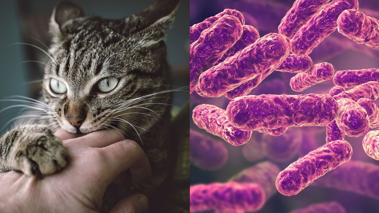 Teen's Rapid 'Schizophrenia' Turns Out To Be A Severe Case Of 'Cat Scratch Disease'