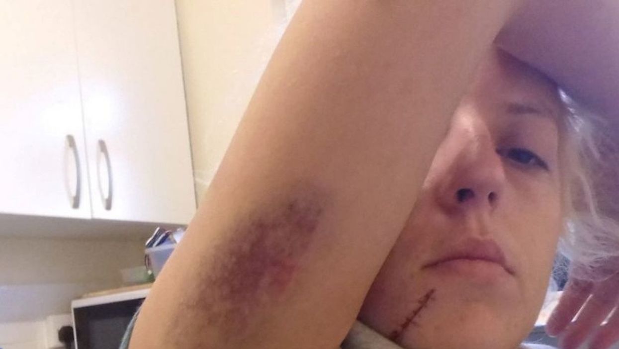 Mom Slams Judges After Neighbor Who Viciously Assaulted Her Is Spared Jail Time