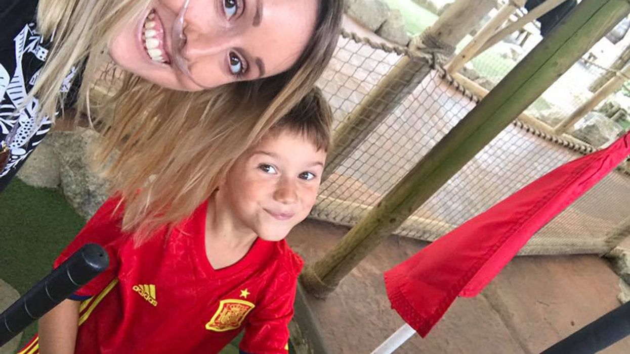 Young Mom Undergoes 30 Amputations In Six Years Due To Health Conditions