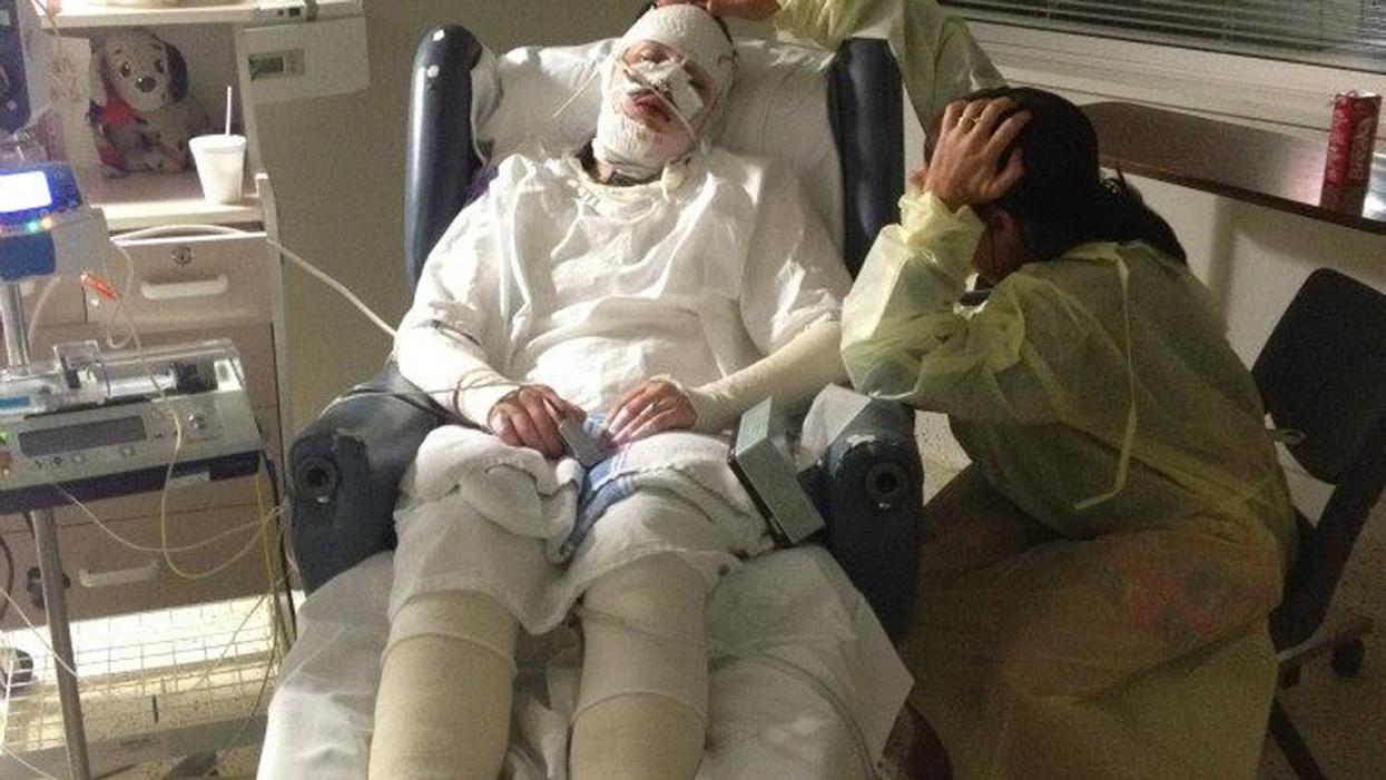Woman 'Burnt Alive' By Reaction To Medication Receives Miraculous News From Doctors