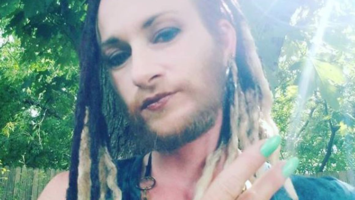 Bearded Lady Who Used To Spend 2 Hours Each Day Trying To Get Rid Of Her Facial Hair Learns To Embrace Her Condition