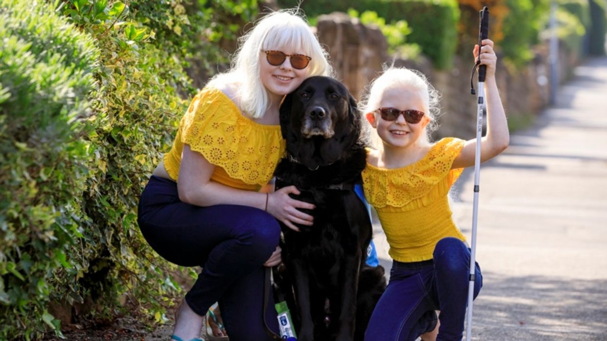 Mom Of Two Daughters With Albinism Explains Their Unbreakable Bond