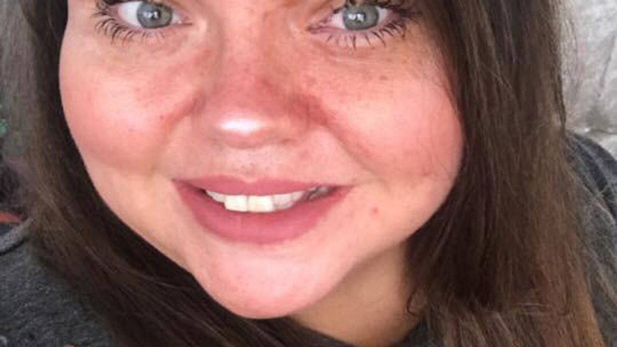 Psoriasis Sufferer Opens Up About How 95 Percent Of Her Body Is Covered By Painful Leopard-Like Spots