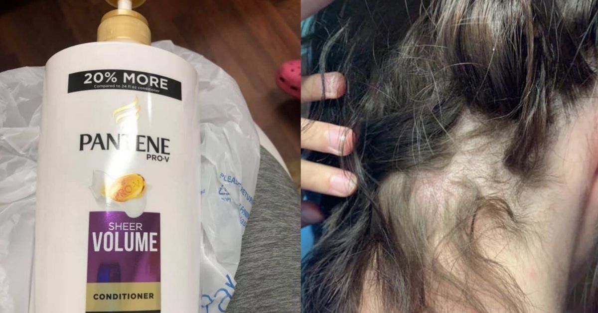 Wisconsin Woman's Hair Falls Out After Buying Conditioner Mixed With Nair Amid Growing Trend Of Product Tampering