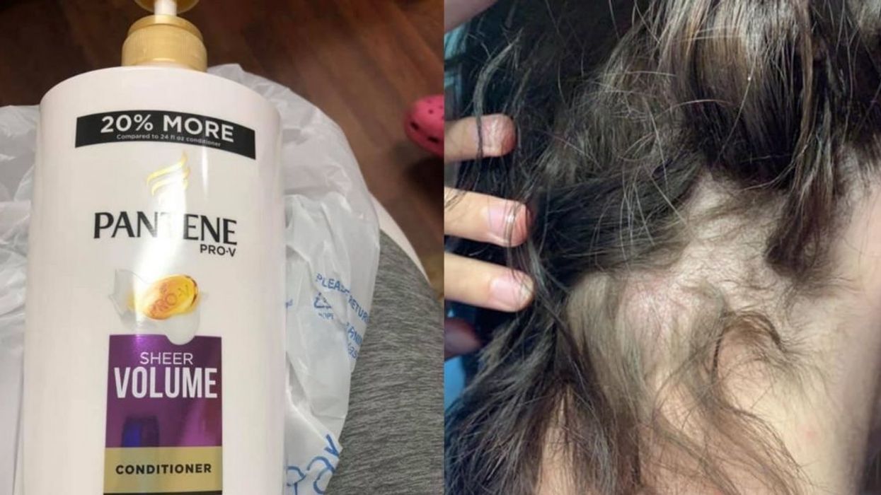 Wisconsin Woman's Hair Falls Out After Buying Conditioner Mixed With Nair Amid Growing Trend Of Product Tampering