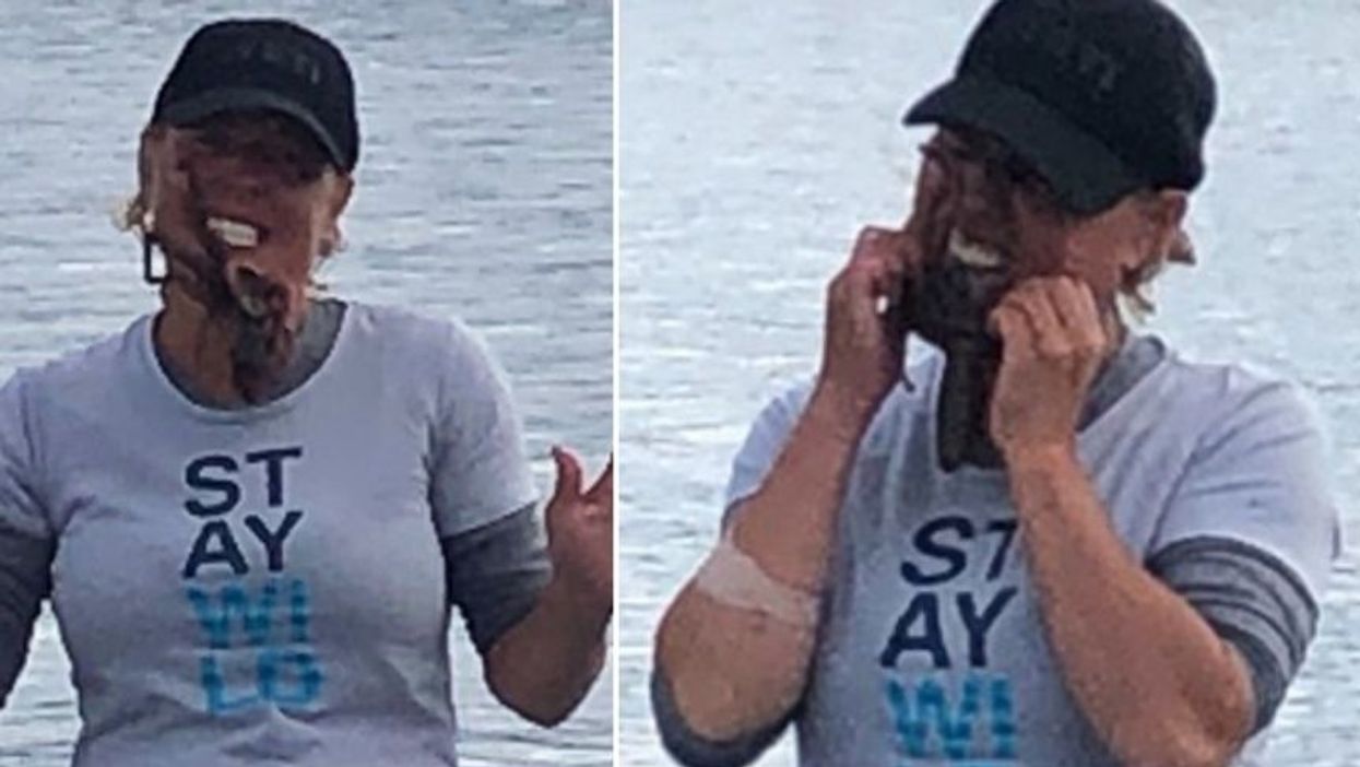 Octopus Injects Venom Into Washington Woman's Face When She Poses With It For Goofy Photo Op