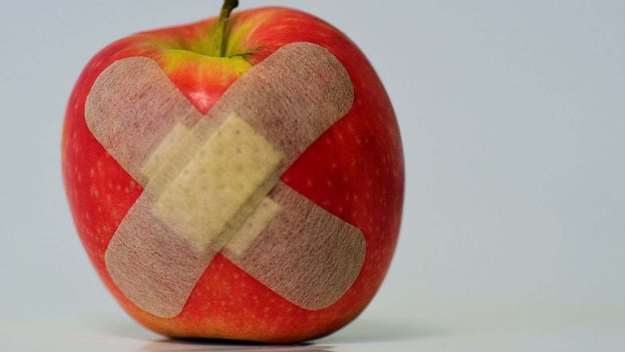 Clumsy People Explain The Stupidest Way They've Been Injured