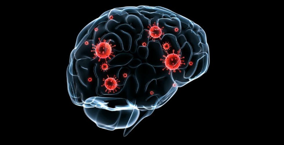 Forget Zombies. These Amoebas Will Eat Your Brain, And Their Peak Season Is Underway