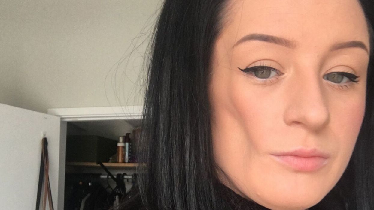 Woman With Rare Condition That Made Her Face Sink In Has Cheek Rebuilt With Fat From Her Stomach