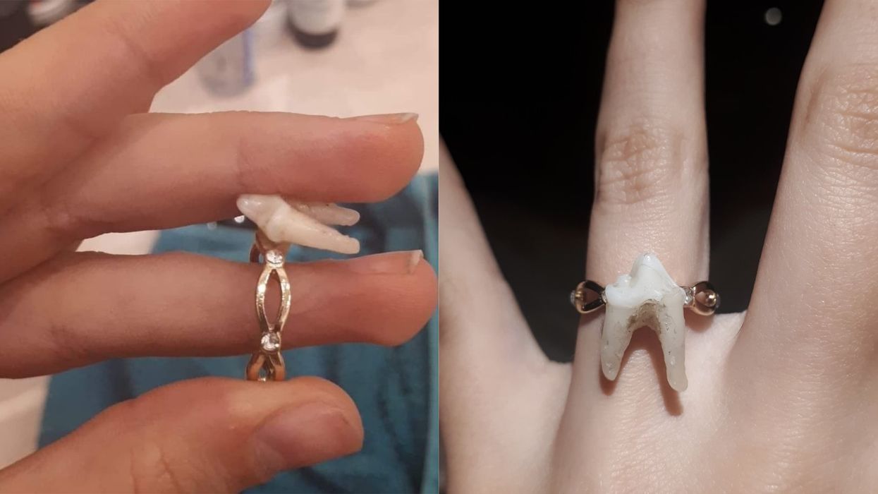Couple's Promise Rings Made From Poodle And Wolf Teeth Cause Stir Online
