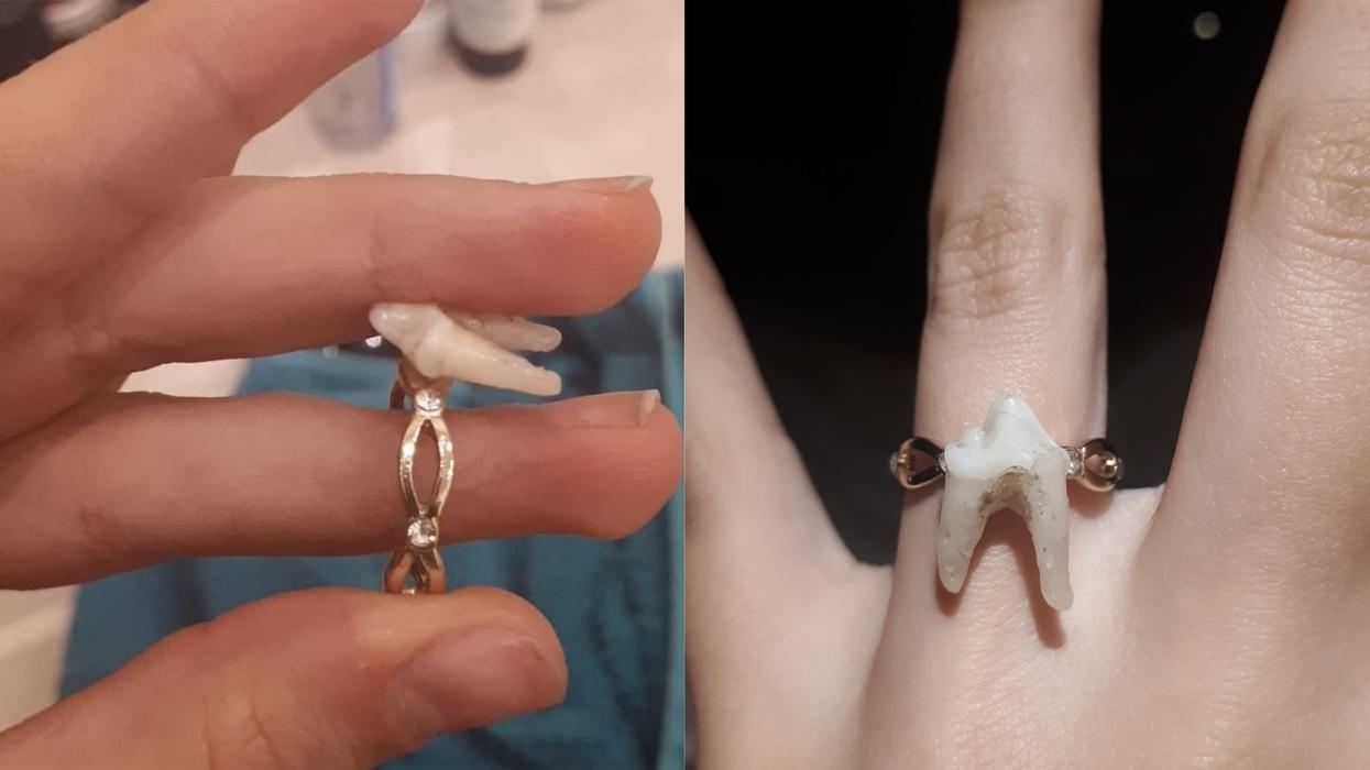 Couple's Promise Rings Made From Poodle And Wolf Teeth Cause Stir Online